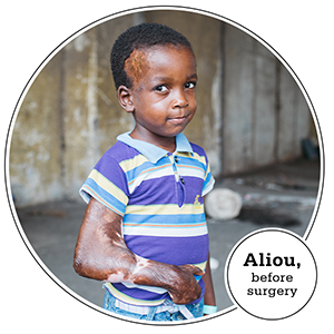 Aliou before surgery