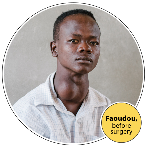 Faoudou before surgery