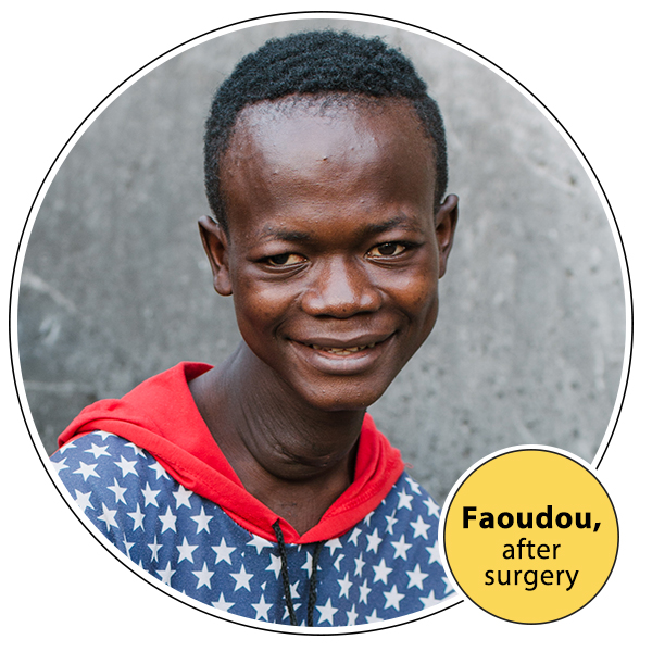 Faoudou after surgery